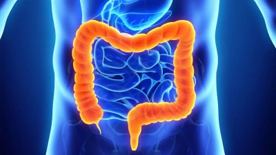 Κολονοσκόπηση, για την πρόληψη του καρκίνου του παχέος εντέρου