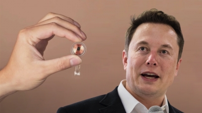 Τσιπάκια στον εγκέφαλό μας: Ξεκινούν πλέον οι κλινικές μελέτες σε ανθρώπους - Elon Musk: «Θα βάλω και εγώ εμφύτευμα»