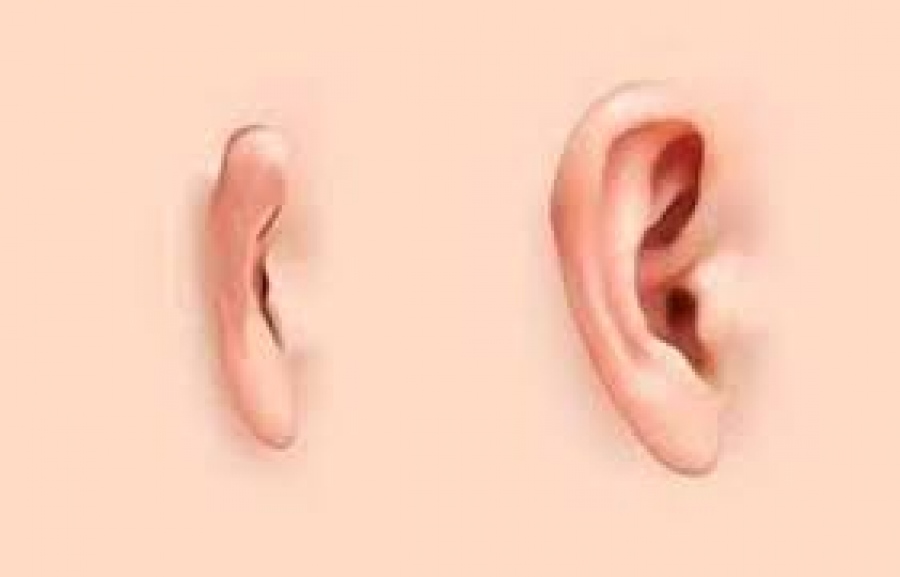 Απίστευτο: Γεγονός η πρώτη μεταμόσχευση αυτιού στο πόδι - Γιατί τοποθετήθηκε εκεί!