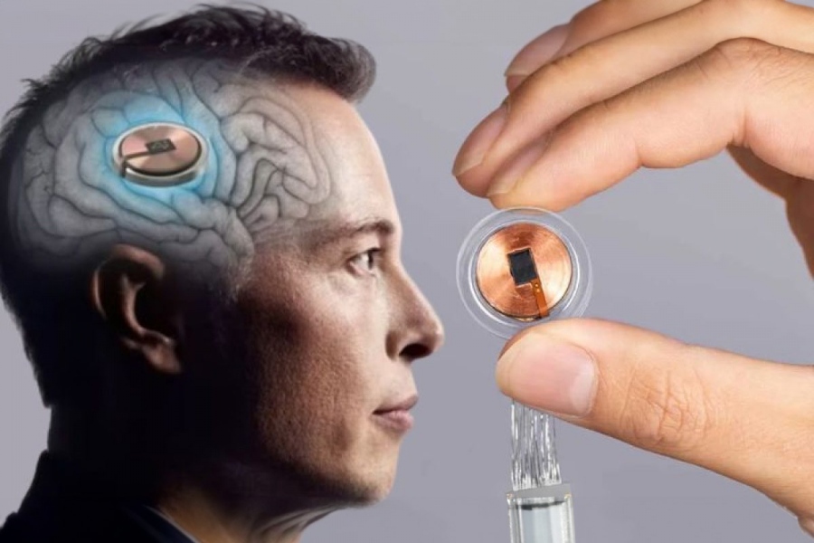 Θαύμα ή εφιάλτης; - Η Neuralink του Musk εμφυτεύει τα πρώτα εγκεφαλικά chipάκια μετάφρασης των σκέψεων σε λέξεις