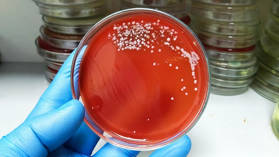 Συναγερμός στον ΕΟΔΥ: Πρώτος θάνατος παιδιού από στρεπτόκοκκο Α στην Ελλάδα - Πώς μεταδίδεται