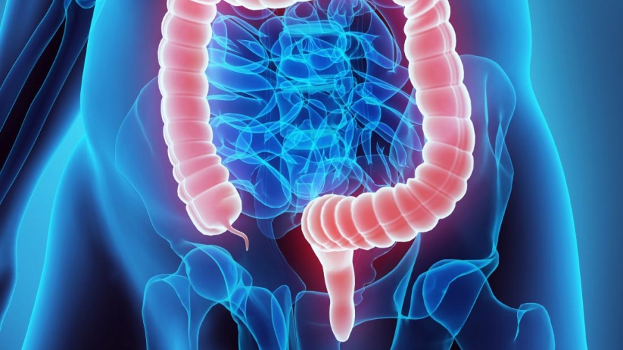 Η ζωή έπειτα από επέμβαση εντέρου - Τι να περιμένουμε και πώς να προσαρμοστούμε