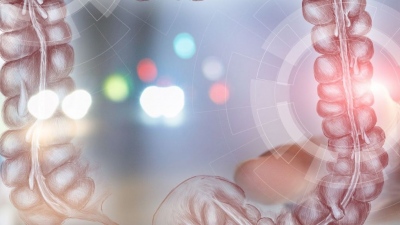 Εκκολπωμάτωση παχέος εντέρου: Παράγοντες κινδύνου και θεραπευτικές επιλογές