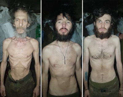 Zelensky’s crime – Shocking photos of skeletal Ukrainians on the front line – 17 days without food