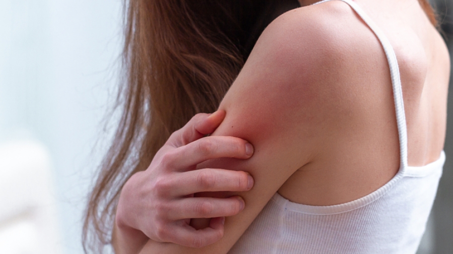 Ψωρίαση: Τι πρέπει να γνωρίζετε για την καλύτερη αντιμετώπιση της