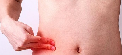 Οξεία σκωληκοειδίτιδα - Τα συμπτώματα και η θεραπεία της πάθησης