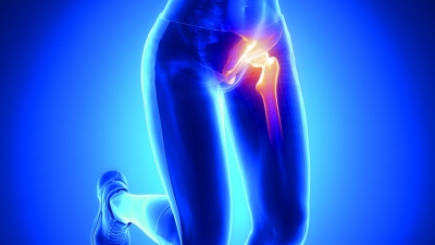 Αρθροπλαστική ισχίου: Ποιες οι προϋποθέσεις για την επιτυχία της;