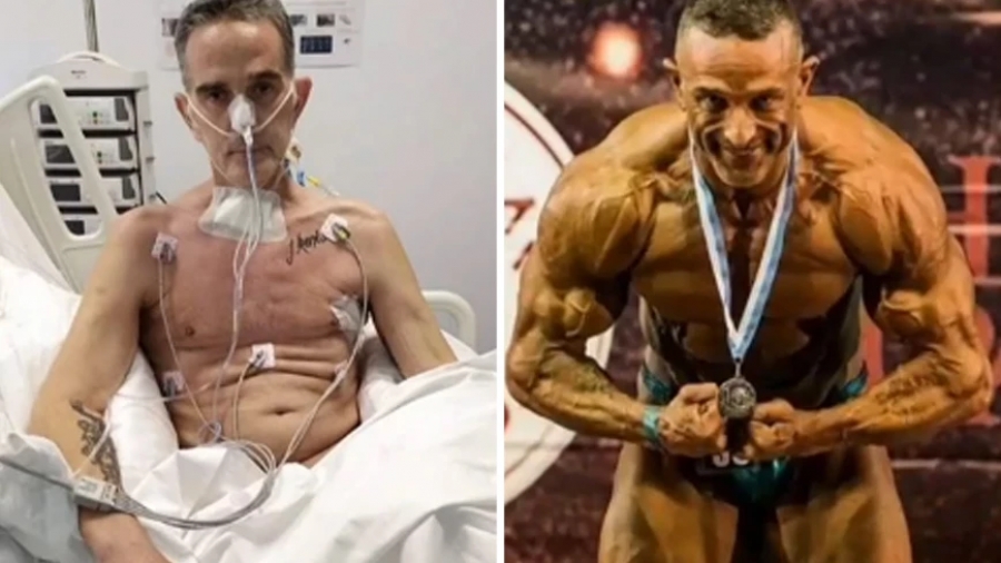 Σοκάρει ο παγκόσμιος πρωταθλητής Βασίλης Μοϊντίνης: Έχασε 42 κιλά και έμεινε διασωληνωμένος δύο μήνες