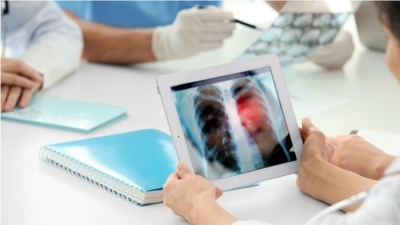 Η ψηφιακή τεχνολογία εκπαιδεύει επεμβατικούς πνευμονολόγους
