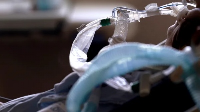Σπάνιο ιατρικό επίτευγμα: Έβαλαν εμφυτεύματα στήθους σε ασθενή που χρειαζόταν μεταμόσχευση πνευμόνων, του έσωσαν τη ζωή