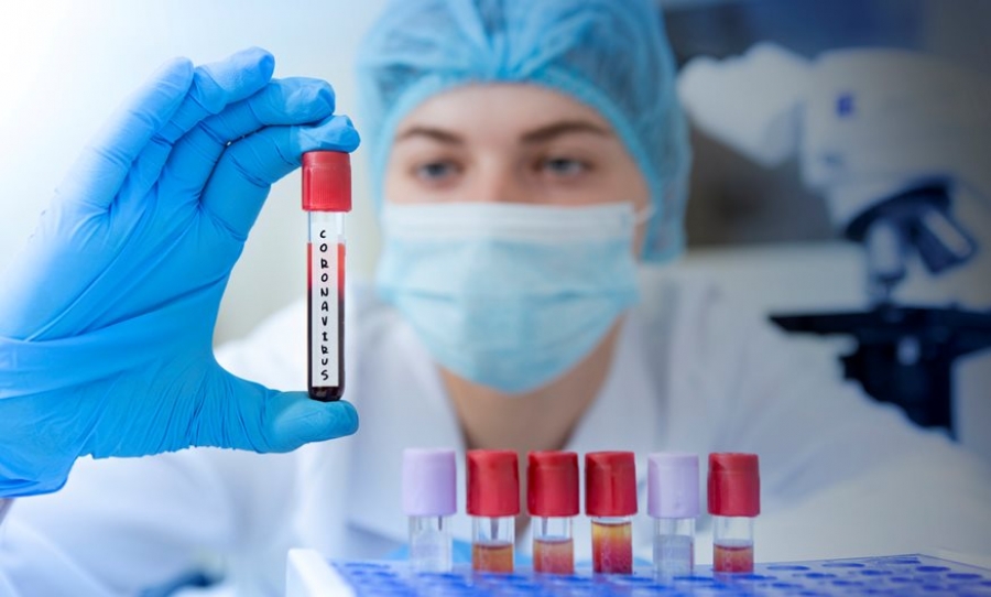 Σημεία δωρεάν ελέγxου Covid-19 την Κυριακή 27 Μαρτίου 2022, πανελλαδικά