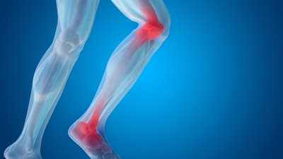 Παθήσεις αρθρικού χόνδρου: Νεότερες θεραπευτικές εξελίξεις