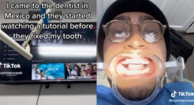 Μεξικό: Οδοντίατρος παρακολουθούσε YouTube για το... πώς θα φτιάξει το δόντι του ασθενούς - Το βίντεο με τα 1,3 εκατ. views