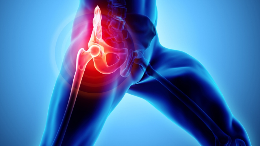 Τεχνική AMIS: Η πλέον φιλική προς τον ασθενή θεραπεία της οστεοαρθρίτιδας