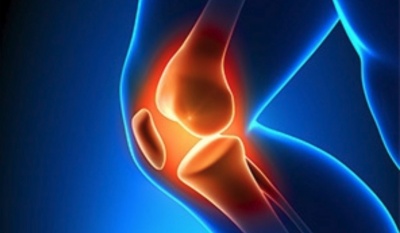 Ρήξη Μηνίσκου: Όλα όσα πρέπει να ξέρετε