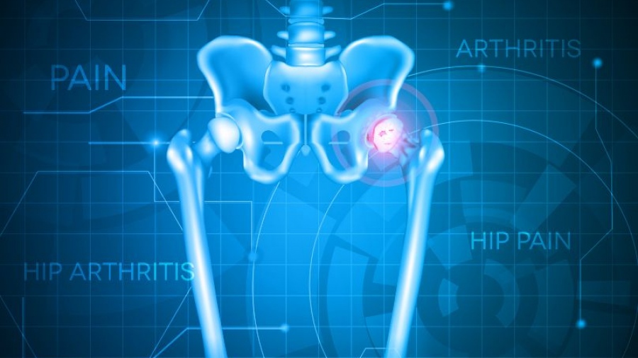 Εξελίξεις στην ολική αρθροπλαστική ισχίου