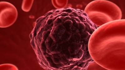 Ο 9 τρόποι για να μειώσετε τον κίνδυνο καρκίνου μέχρι και 50%