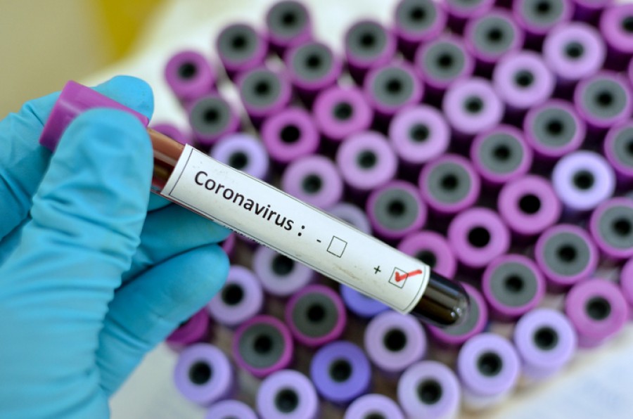 Παρατηρητήριο για κορωνοϊό: Στο 0,4 ο δείκτης μετάδοσης -Αυξημένες οι νοσηλείες σε απλές κλίνες