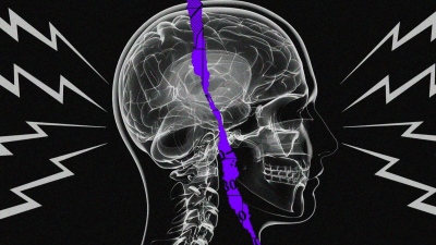 Παγκόσμια απειλή: Οι ΗΠΑ απέκτησαν το υπερηχητικό όπλο με ρωσικά εξαρτήματα που προκαλεί το «Σύνδρομο της Αβάνας»