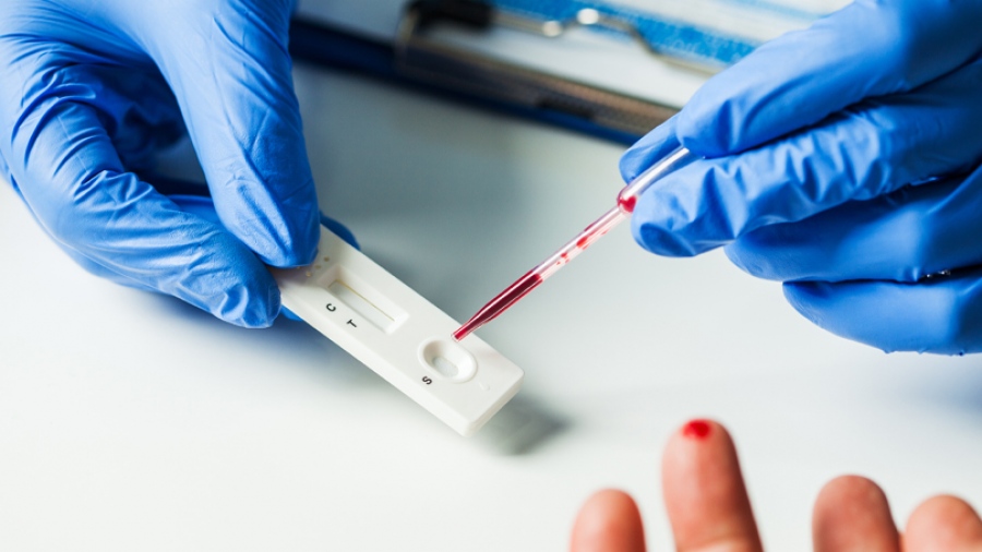 Σακχαρώδης Διαβήτης: Η σύγχρονη μεταβολική πανδημία