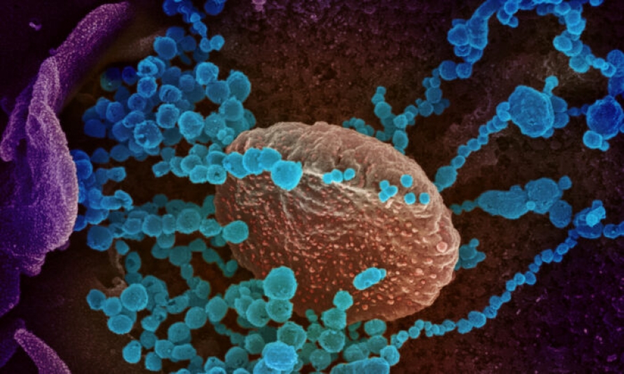 Μελέτη – ΗΠΑ: Πλήρως εμβολιασμένοι οι τέσσερις στους 10 ασθενείς με Covid σε νοσοκομείο της Καλιφόρνια