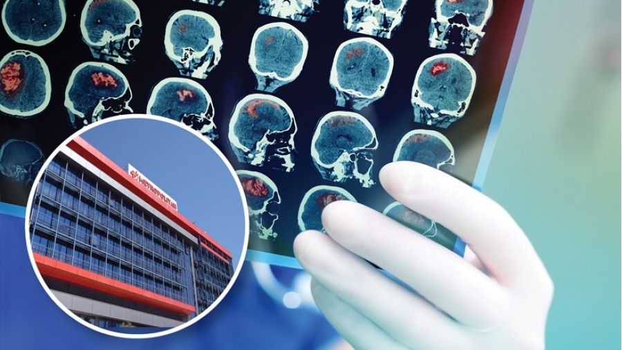 Τεχνητή νοημοσύνη για αντιμετώπιση εγκεφαλικών επεισοδίων στο Metropolitan Hospital