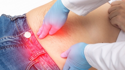 Νέα ελάχιστα επεμβατική μέθοδος για την αποκατάσταση της μετεγχειρητικής κήλης