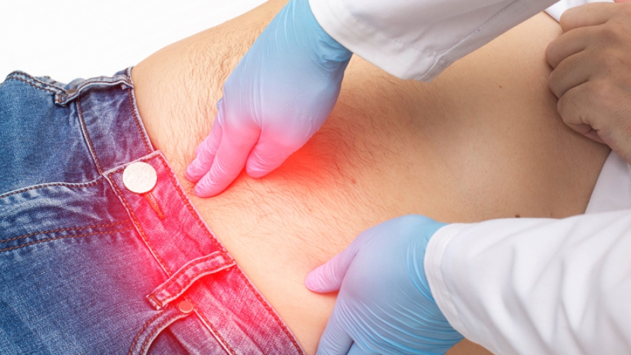 Νέα ελάχιστα επεμβατική μέθοδος για την αποκατάσταση της μετεγχειρητικής κήλης