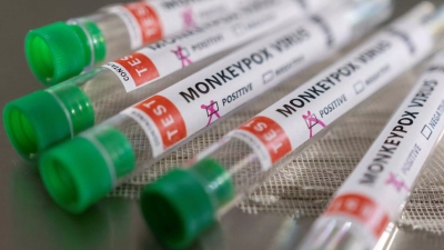 Ευλογιά των πιθήκων - Σε 13 αυξήθηκαν τα κρούσματα στην Ελλάδα