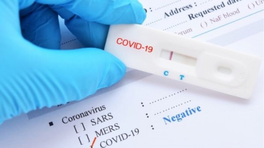 Δωρεάν self test για όλους από σήμερα 6/12 – Έκκληση από τους ειδικούς