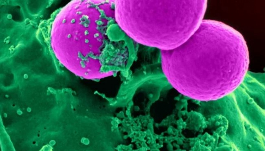 Θρίλερ στις ΗΠΑ - Κινέζοι εισήγαγαν επικίνδυνο μύκητα... αγροτρομοκρατικό όπλο