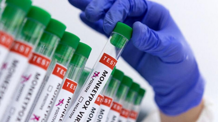 Μεξικό: Επιβεβαιώθηκε το πρώτο κρούσμα ευλογιάς του πιθήκου