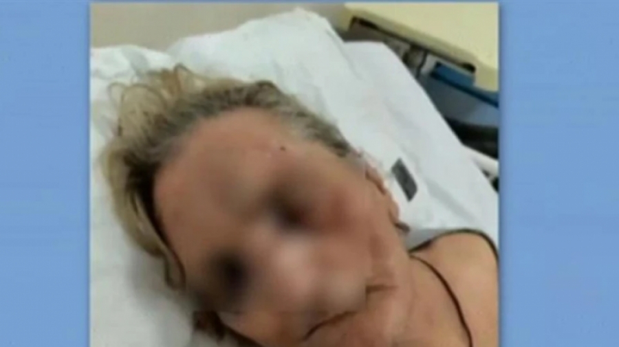 Σοκαριστικό περιστατικό στο Τζάνειο: Άγριος ξυλοδαρμός ηλικιωμένης από αποκλειστική νοσοκόμα