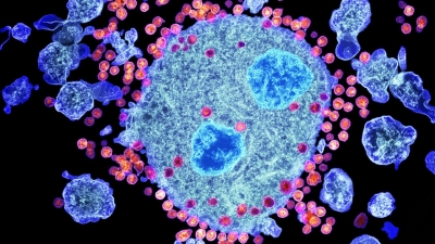 Φάρμακο για τον καρκίνο ενδέχεται να ανοίγει το δρόμο για πλήρη ίαση του HIV