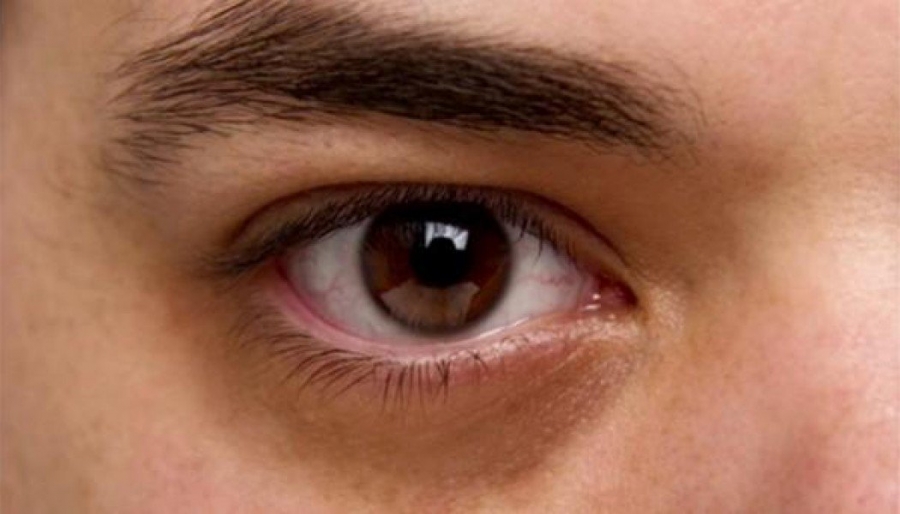 British Journal of Ophthalmology: Απίστευτος αλγόριθμος εντοπίζει από τα... μάτια αν κινδυνεύετε από πρόωρο θάνατο