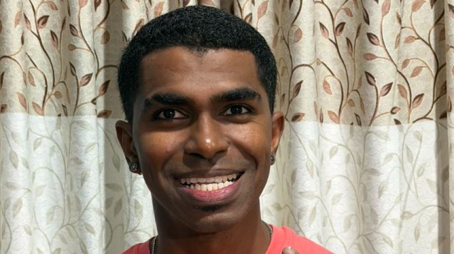 Αδιανόητο ρεκόρ Guinness - Βρέθηκε άνδρας με 42 δόντια, δέκα περισσότερα από τον μέσο άνθρωπο (vid)