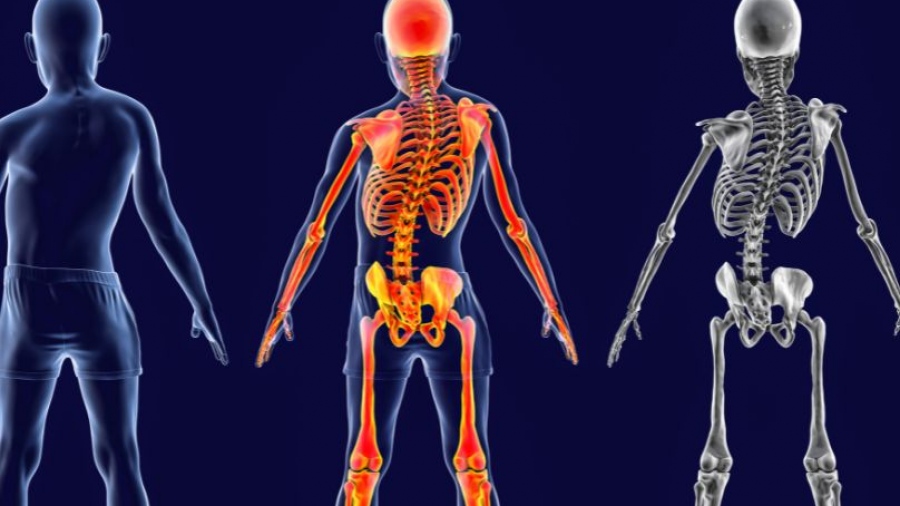 Σπονδυλική Στήλη: Αντιμετώπιση παραμορφώσεων με χειρουργική πλοήγηση