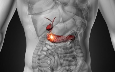 Καρκίνος παγκρέατος: Στόχος η αύξηση της πενταετούς επιβίωσης