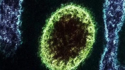 Ποια είναι τα συμπτώματα που προκαλεί ο νέος ιός Langya που εντοπίστηκε στην Κίνα