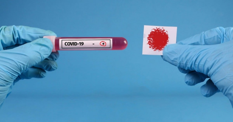 Τέλος και στα τελευταία μέτρα κατά του COVID-19