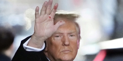 Πώς εξήγησε ο Trump τα μυστηριώδη κόκκινα σημάδια στο χέρι του