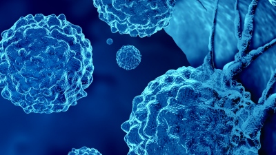 Μεταστατικός καρκίνος - Όταν δεν εντοπίζεται η αρχική εστία