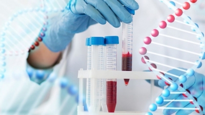 Η κολχικίνη στη μάχη κατά του κορωνοϊού – Ποιους ασθενείς αφορά