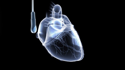 Υπέρηχοι Καρδιάς: Ποια είναι τα νεότερα δεδομένα;