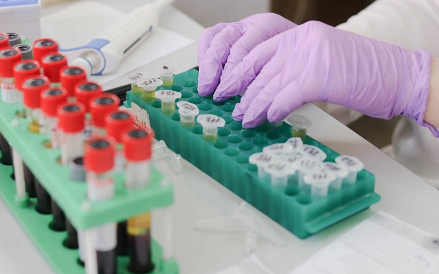 ΗΠΑ - AIDS: Θεραπεύτηκε από τον ιό HIV ο γηραιότερος ασθενής