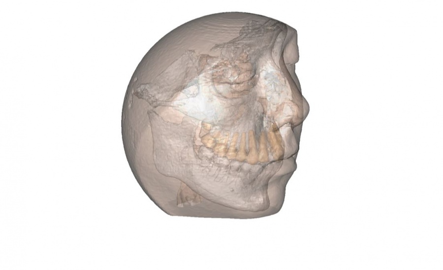 Η ζωή είναι 3D - Τώρα, είναι και η χειρουργική μόνο στο Metropolitan