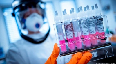 Μακάβρια στοιχεία: Η θνησιμότητα μετά τα εμβόλια covid αυξήθηκε κατά 40% - Σοκάρει η ανάλυση Chudov για τους πρόωρους θανάτους