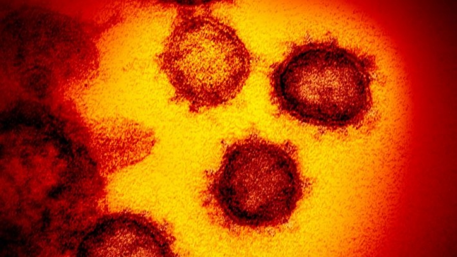 Ινστιτούτο Παστέρ: Έντονα αυξητική τάση της εποχικής γρίπης - Οφείλεται σε ποσοστό 92% στον ιό γρίπης Α (Η1N1)