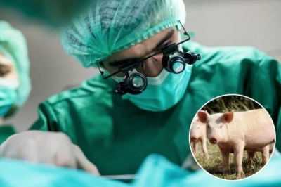 Αδιανόητο ιατρικό πείραμα! - Μεταμόσχευση πνεύμονα από γουρούνι κατέληξε σε... θανάσιμη μάχη!