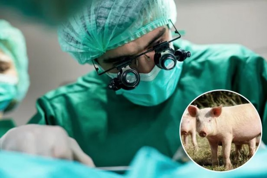 Αδιανόητο ιατρικό πείραμα! - Μεταμόσχευση πνεύμονα από γουρούνι κατέληξε σε... θανάσιμη μάχη!